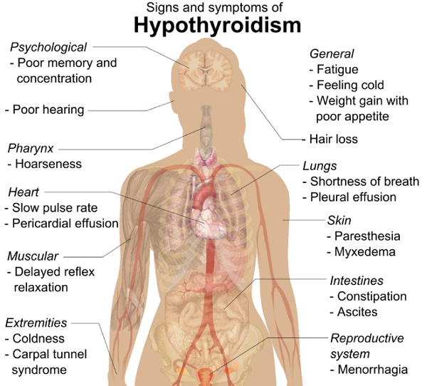 Thyroid problems