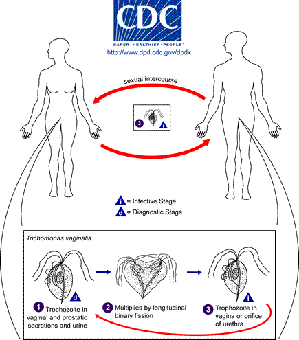 Trichomoniasis